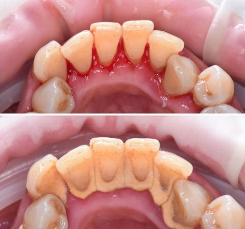 Kezelés előtt és után