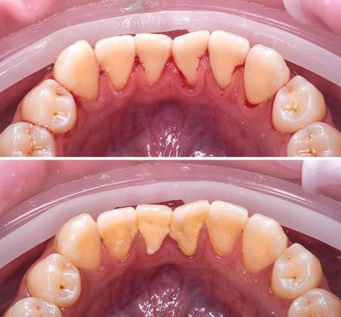 Kezelés előtt és után