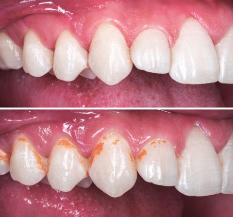 Kezelés előtt és után