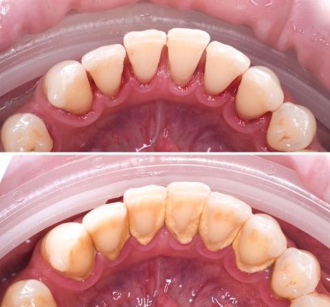 Kezelés előtt és után