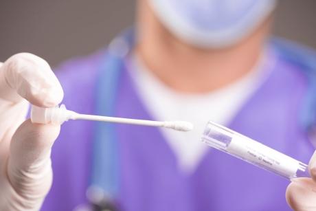 Szájüregi HPV szűrés
